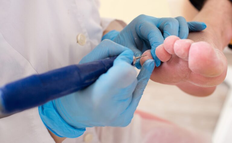 Chiropody Solutions Manchester